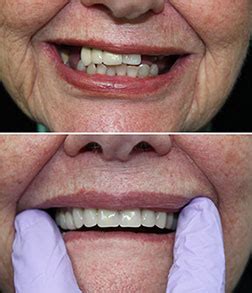 guelph denture clinic.